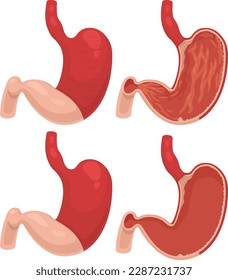 Vector illustration of stomachs in different views, the inner surface of the stomach, empty stomach