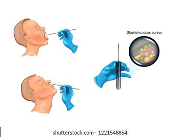 vector illustration of a swab from the nose and throat