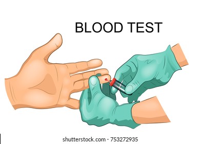 vector illustration of the taking of blood from a finger for analysis