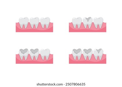 Ilustración vectorial del icono de los dientes, dientes limpios y caries