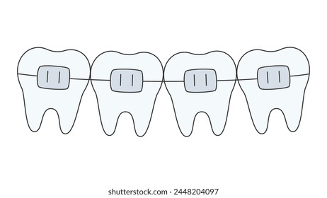 vector illustration of a teeth row with braces. dental care concept