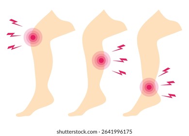 Vector illustration of three human legs showing pain areas at the knee, calf, and ankle. Suitable for medical, anatomy, physiotherapy, and healthcare purposes.