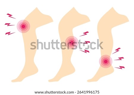 Vector illustration of three human legs showing pain areas at the knee, calf, and ankle. Suitable for medical, anatomy, physiotherapy, and healthcare purposes.