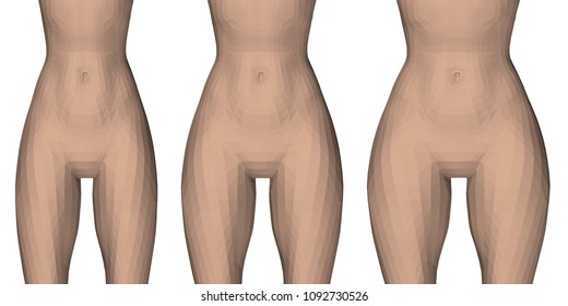 Vector illustration with three types of female waist and hips. From slender to fluffy thighs. Sequence of hips thickening. 3D.