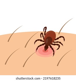 Vector Illustration, A Tick Scientific Name Ixodes Ricinus, A Dangerous Insect, Isolated On White Background.