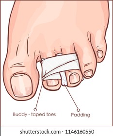 vector illustration of a Toe Buddy Taping