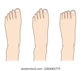 Vector illustration of toe shapes by type