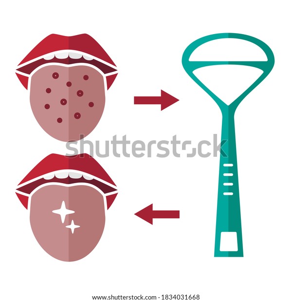 Vector illustration of\
tongue hygiene. Tongue cleaner, dirty and clean tongue isolated in\
white. Dental care. Oral hygiene and dental procedures concept.\
Flat style