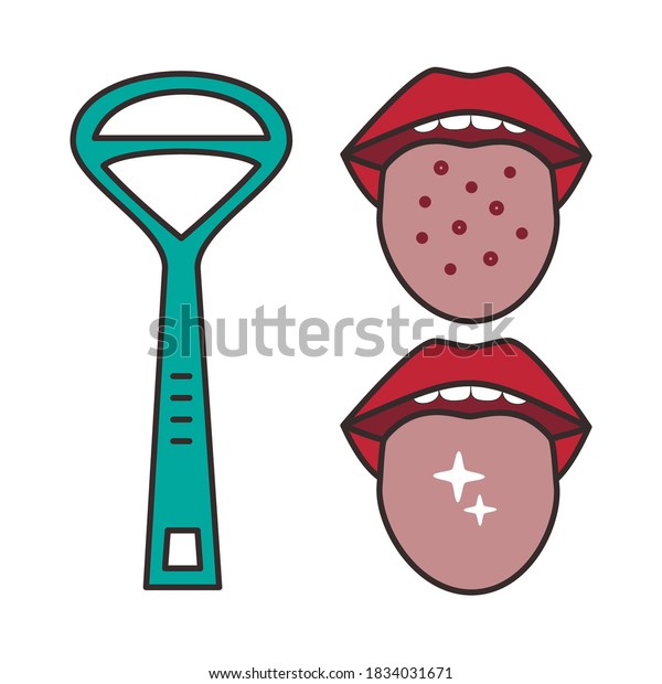 Vector illustration of\
tongue hygiene. Tongue cleaner, dirty and clean tongue isolated in\
white. Dental care. Oral hygiene and dental procedures concept.\
Flat style