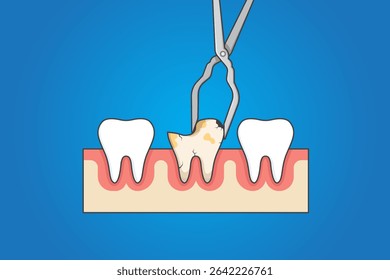 Vector illustration of Tooth Extraction with Dental Tools, emphasizing oral health and dental care