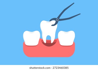 Vector illustration of tooth extraction procedure with dental forceps removing a tooth. Concept of dental surgery, oral medicine, and professional dental treatment.
