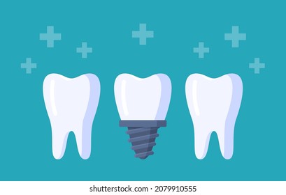 Vector illustration of tooth row. Three teeth isolated on a blue background. 