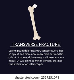 vector illustration of a transverse fracture