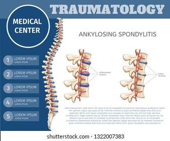 Vector Illustration Traumatology Medical Center. Flat Banner Ankylosing Spondylitis. Specializing Medical Journal for Surgeons. Introductory Colorful Booklet Medical Clinic for Treatment Spine.