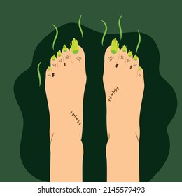 Vector illustration. Ugly feet. Smelly feet. Long toe nails. Dirty feet. Long toenails. 