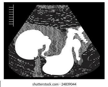 vector illustration of an ultrasound... image contained in clipping mask