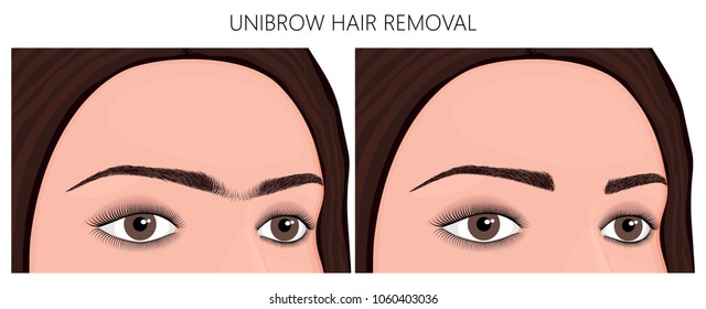 Vector illustration. Unibrow on woman's face before, after excess hair remove. Close up view. For advertising and beauty publications. EPS 10.