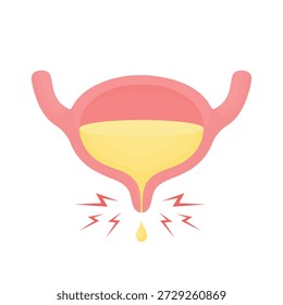 Vektorgrafik der Harnblase mit Leckageproblem, einzeln auf weißem Hintergrund. Einfache medizinische Illustration für Projekte in den Bereichen Inkontinenz, Urologie, Gesundheitswesen und medizinisches Design.