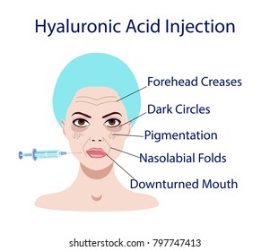 Vector illustration with usage of hyaluronic acid