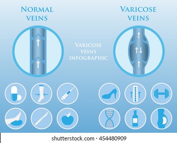 Vector illustration of a varicose vein and normal vein. Phlebology vector infographics.