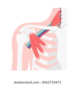Vector illustration of where thoracic outlet syndrome occurs