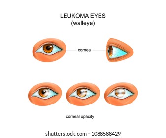 ilustración vectorial de un ojo blanco. walleye.