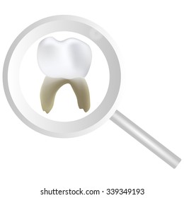 a vector illustration of a white tooth with yellow roots under the dental magnifying tool