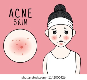 vector illustration woman face acne skin on pink background.