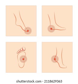Vector illustration, woman foot pain and toes pain and soles of feet, nerve inflammation disease Concept, vector sketch