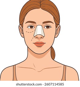 Vector illustration of a womans face after rhinoplasty, wearing a nasal splint. Isolated design on white background. Perfect for medical or recovery themed visuals.