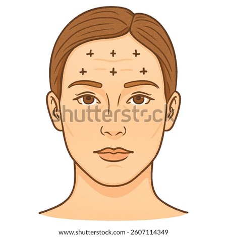 Vector illustration of a womans face with marked Botox injection points. Isolated design on white background. Ideal for use in infographics or cosmetic clinic visuals.