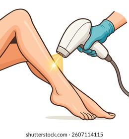 Vector illustration of a woman's smooth leg undergoing laser hair removal. Isolated design on white background, ideal for cosmetic treatment visuals.