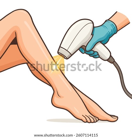 Vector illustration of a woman's smooth leg undergoing laser hair removal. Isolated design on white background, ideal for cosmetic treatment visuals.