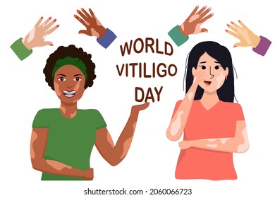 vector illustration with women of different races, isolated on a white background. Illustration on the theme of World Vitiligo Day