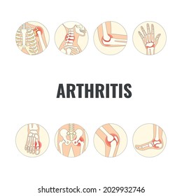 Vector Illustration of World Arthritis Day
