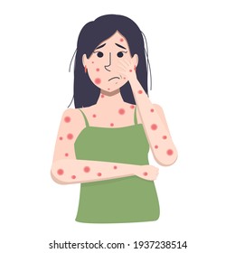 Vector Illustration Of A Young Asian Woman With Itchy, Blistered Skin. The Symptom Of Measles Or Chickenpox Acne.