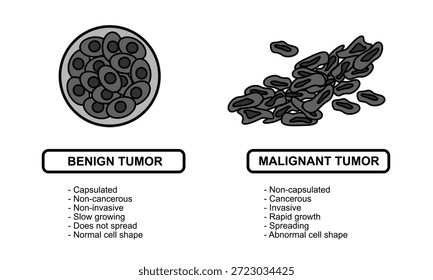 Ilustraciones vectoriales de tumores malignos y benignos en los tejidos corporales. Diseminación de las células cancerosas. Ilustraciones vectoriales médicas para la educación, carteles, clínicas y ciencias.