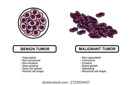 Ilustraciones vectoriales de tumores malignos y benignos en los tejidos corporales. Diseminación de las células cancerosas. Ilustraciones vectoriales médicas para la educación, carteles, clínicas y ciencias.