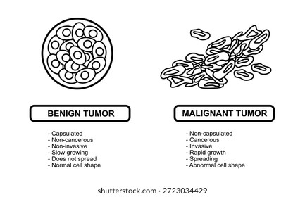 Ilustraciones vectoriales de tumores malignos y benignos en los tejidos corporales. Diseminación de las células cancerosas. Ilustraciones vectoriales médicas para la educación, carteles, clínicas y ciencias.