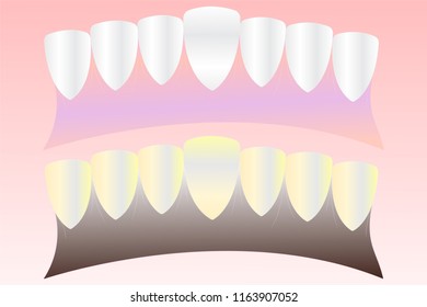 Vector illustrations of teeth and gums