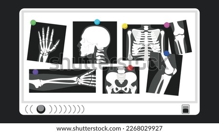 Vector illustrations of various X-ray images of parts of the human body. Cartoon X-ray images are attached to the board: bones of the arms and legs, skull, chest cell of the skeleton, pelvic bones.