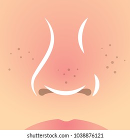 Vector image of acne nose. Pollution skin. Universal use.
