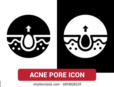 Vector image. Acne pore icons. Skin care image.