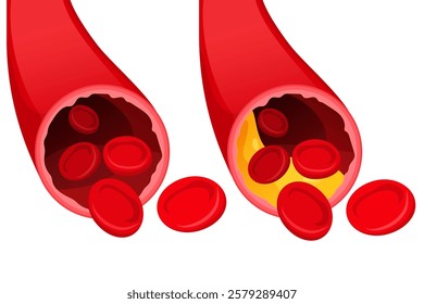 Vector image of artery. Arteries with cholesterol. Medical illustration for studying human and his body. Element for your design.