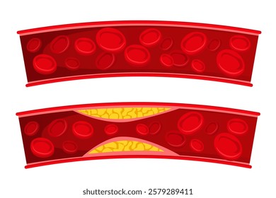 Vector image of artery. Arteries with cholesterol. Medical illustration for studying human and his body. Element for your design.