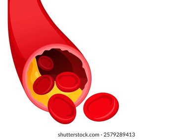 Vector image of artery. Arteries with cholesterol. Medical illustration for studying human and his body. Element for your design.