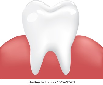 Vector Image Clean Healthy Tooth with Inflamed Gum. Medical Dental Oral Problem. Enamel Cleanliness. Isolated on White Background. Human teeth Stages of Gum Disease Vector Illustration .