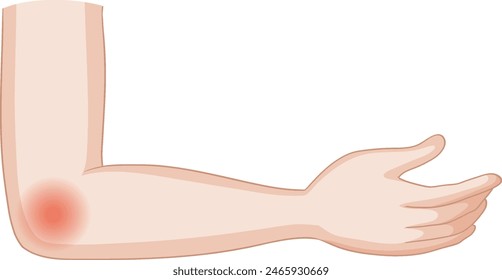 Vector image of an elbow with pain