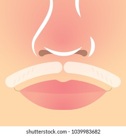 Vector image of hair removal on face. Art style. Universal use. Original image. Isolated image.