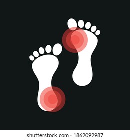 Imagen vectorial. Icono de un pie con dolor localizado.